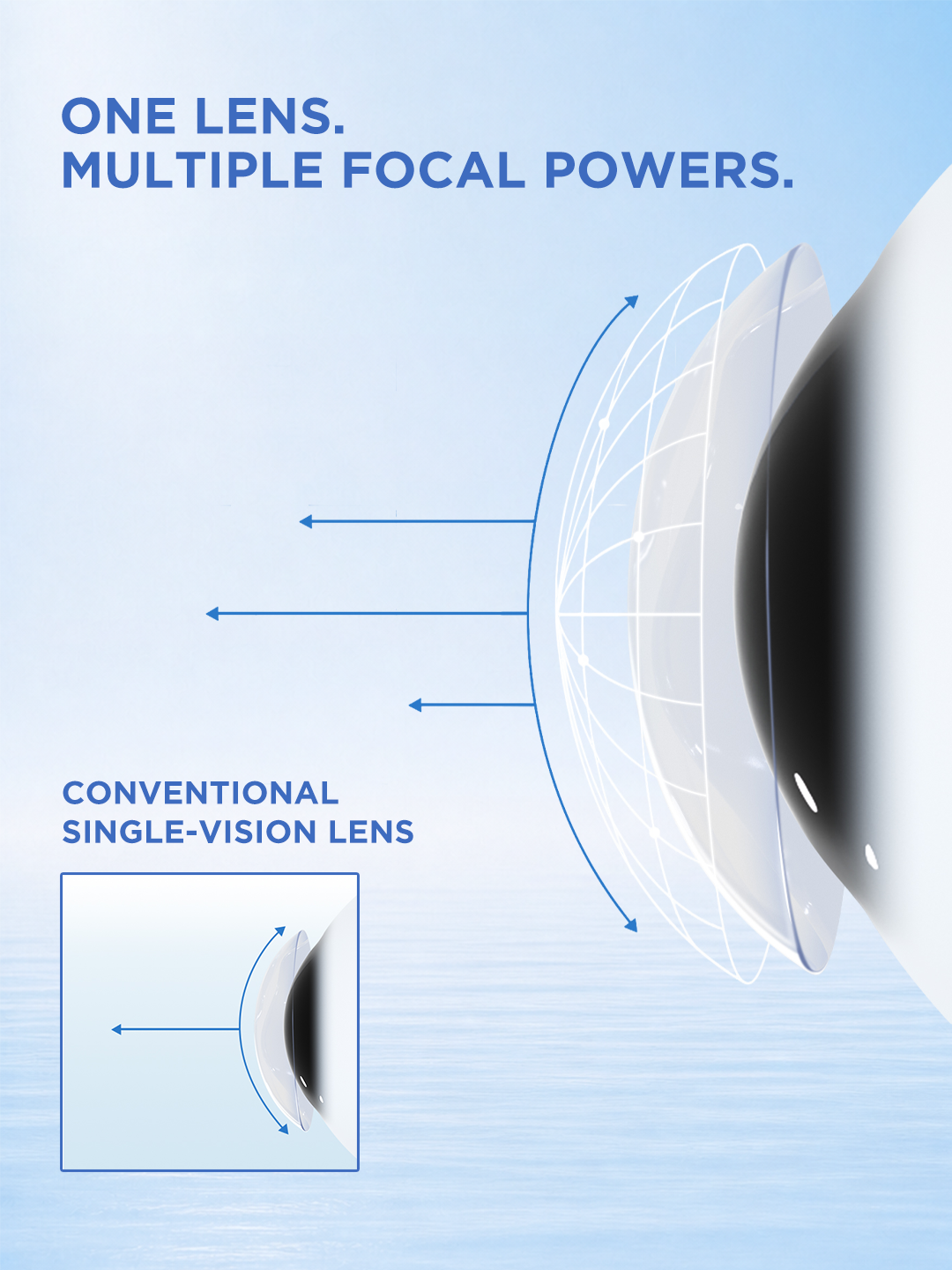 Illustration comparing a progressive multifocal contact lens with multiple optical powers to a conventional single-vision lens.